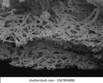 Chicken Eggshell Membrane Electron Microscopy