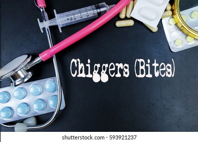 Chiggers (Bites)  Word, Medical Term Word With Medical Concepts In Blackboard And Medical Equipment Background.