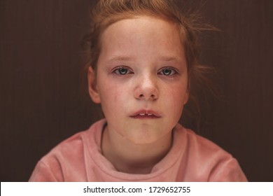 Child Abuse. Sad And Lonely Girl Crying. Injured Child Posing As Victim Of Domestic Violence