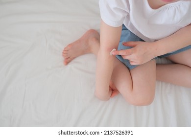 The Child Applies The Cream To Atopic Skin. Body Care. Atopy, Eczema, Dermatitis. Treatment Of Atopic Dermatitis