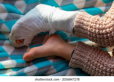 A Child With A Bandage On Leg Heel Fracture. Broken Right Foot, Bone, Ankle, Leg In Plaster, Splint Of A Toddler. Little Boy Sleeping On A Blue Blanket. Human Healthcare And Medicine Concept