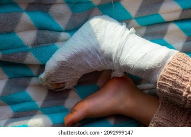 Child With Bandage On Leg Heel Fracture. Broken Right Foot, Bone, Calf, Ankle, Leg In Plaster, Splint Of Toddler. Little Boy Sleeping On A Blue Blanket. Human Healthcare And Medicine Concept