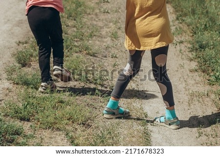 A child with crooked legs in the street, knock-knee
