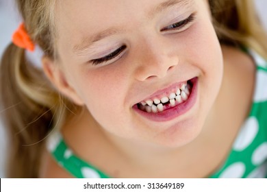 The Child Dropped The First Milk Tooth