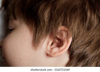 Child Ear Close-up. Copy Space. Deafness. Concept Of Medical Exam And Treatment By An Otolaryngologist. Hearing Check And Recovery. Proper Care And Cleaning Of Ears. Audio Perception Of Information.