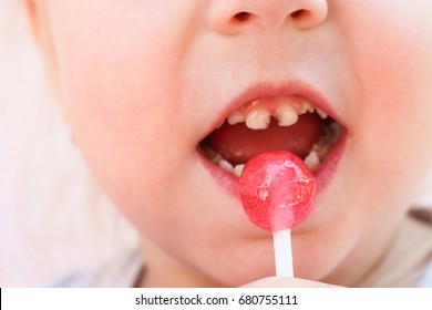 Image result for kids teeth candy