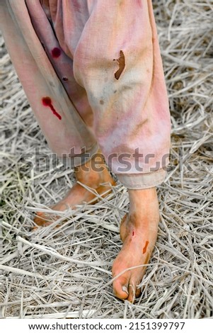 child foot injured with the thorn in wild