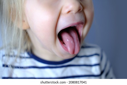 child, girl 2 years old, close-up of part of child's face, children's mouth open, concept of sensory feelings, speech disorders, correction, methods of correctional developmental exercises