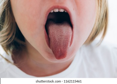 A Child Girl Open Her Mouth And Show Her Tounge