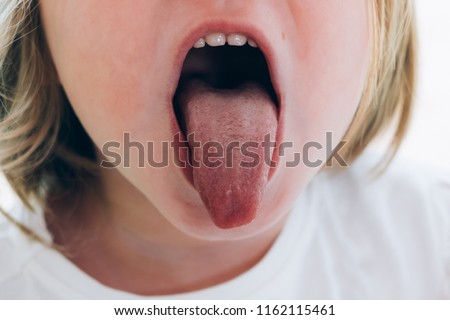 a child girl open her mouth and show her tounge