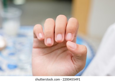 Child Girl Shows Her Finger Nails After Cutting By Herself, Healthy Short Cut Finger Nails