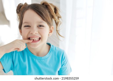 The Child Has Lost A Tooth. Little Girl Without A Tooth. The First Tooth Fell Out. High Quality Photo