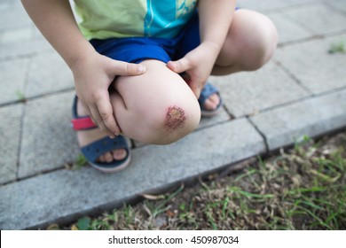 Child Hurt His Knee On The Pavement. Abrasion