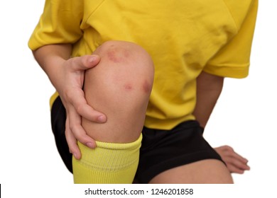 Child Hurt His Knee While Playing Football