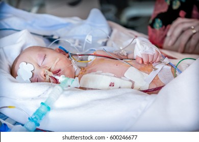 Child In Intensive Care Unit After Heart Surgery. Shallow Depth Of Field.	