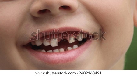 The child lost a tooth. Selective focus. Kid.Concept baby tooth