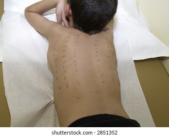 Child Marked For Allergy Test