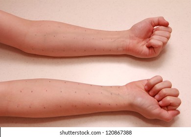 A Child With A Negative Allergy Test