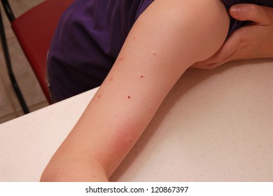 A Child With A Negative Allergy Test