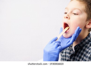 Child With Open Mouth During Medical Examination. The Doctor Checks The Patient's Throat And Tonsils With A Medical Spatula. Light Background, Copy Space.