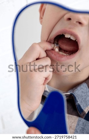 Child pointing at a decayed tooth in the mirror, close-up of dental cavity issues.