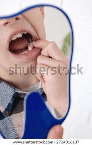 Child pointing at a decayed tooth in the mirror, close-up of dental cavity issues.