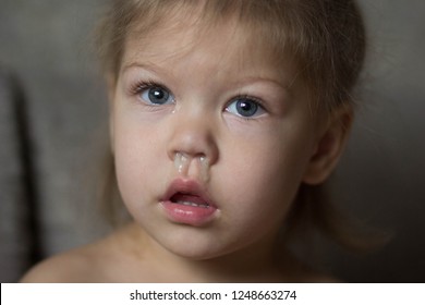 Child With A Runny Nose