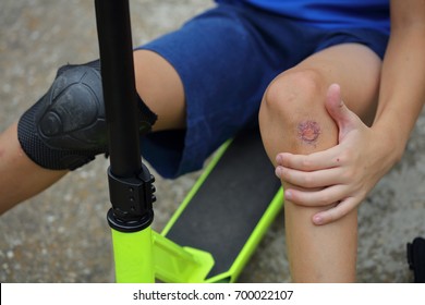 Child With A Scraped Knee. Boy Injured His Leg During Scooter Riding. Kids Safety, Using Protective Knee Pads Concept