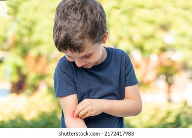 Child Scratching And Looking At His Arm Because It Itches In A Park With Green Background