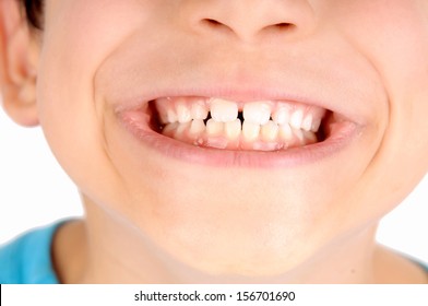 Child Teeth Close Up Isolated In White