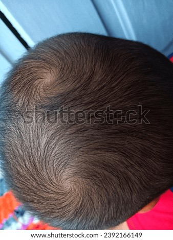 a child with two hair whorls