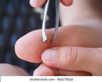 Child Using Tweezers On Big Toe For Removal Of A Splinter In A Callus