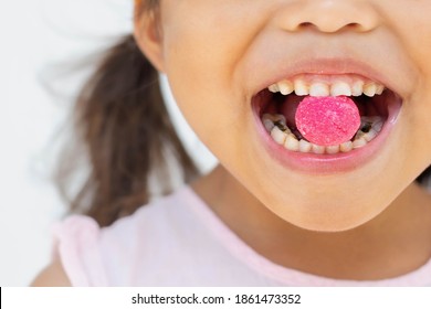 Children With Bad Teeth And Eating Sugar Candy. Oral And Bone Health.