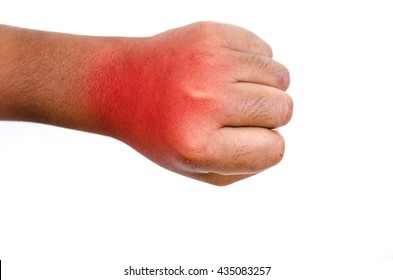 Painful Fist