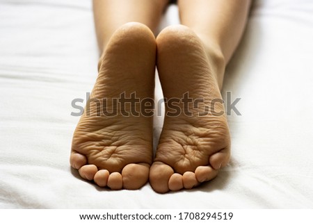 children's heels on a white bed close-up. feet of a child with flat feet lying in bed