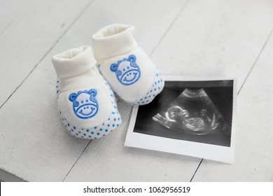 children's shoes next to a photo of ultrasound. The concept of pregnancy and new life, waiting for the newborn.