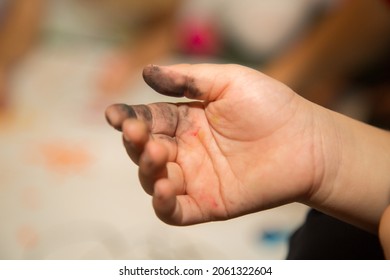 The child's right hand hangs to the side. The soot-stained, gunpowder-burned hand is close at hand.