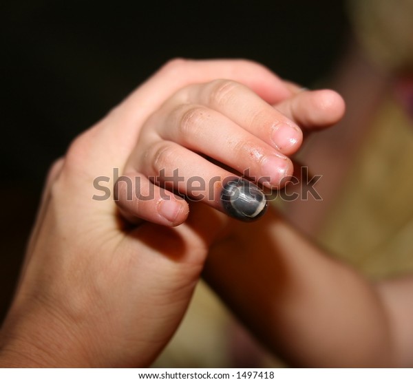Childs Ring Finger Injured By Door Stock Photo Edit Now 1497418