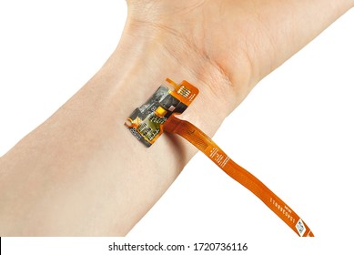 The Chip Is Mounted Under The Skin. Chips Embedding Concept. Chip On Wrist Close Up. Hand On Scars After Laser Surgery.