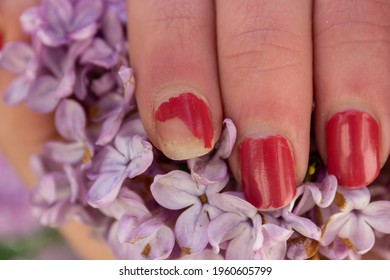 Chipped Nail Polish. Woman's Fingers With Chipped Nail.