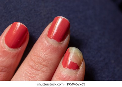 Chipped Nail Polish, Yellow Nails. 