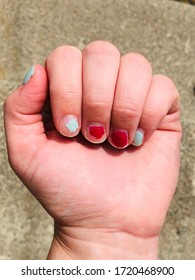 Chipped nails on a warm summer day 