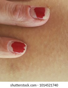 Chipped Red Nail Polish On Woman's Fingers.