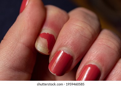 Chipped Red Nail Polish, Yellow Nails. 