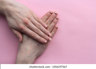 Chipped, Stratified Nails. Nails After Gel Polish. The Concept Of Nails Before The Manicure.untidy Hands On Pink Background.the View From The Top