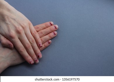 Chipped, Stratified Nails. Nails After Gel Polish. The Concept Of Nails Before The Manicure.untidy Hands On A Gray Background.the View From The Top.