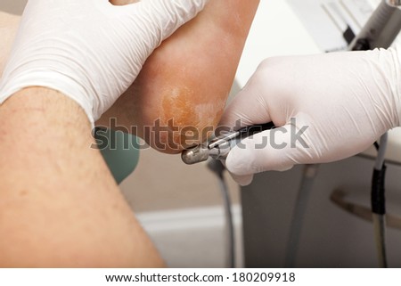 Chiropodists grinds with a machine dry skin at the heel of the foot of a woman