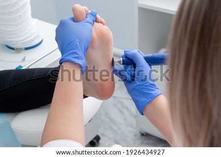 Chiropodists removes dry skin at the heel of the foot of a woman