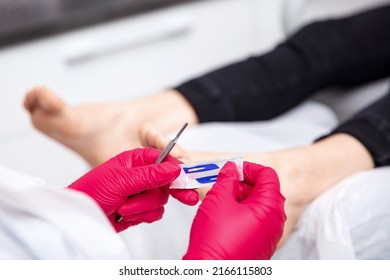 Chiropodists Unpacks A Scalpel Blade From The Sterile Packaging