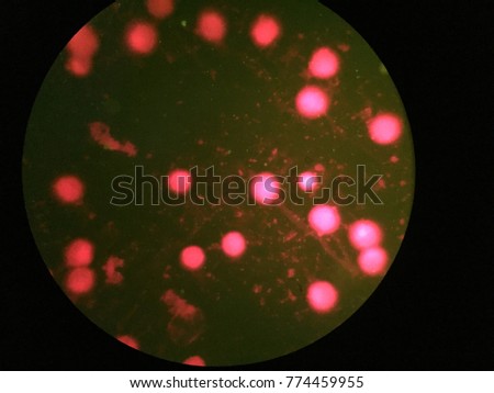 Chlamydia with elementary Cell (green Color)